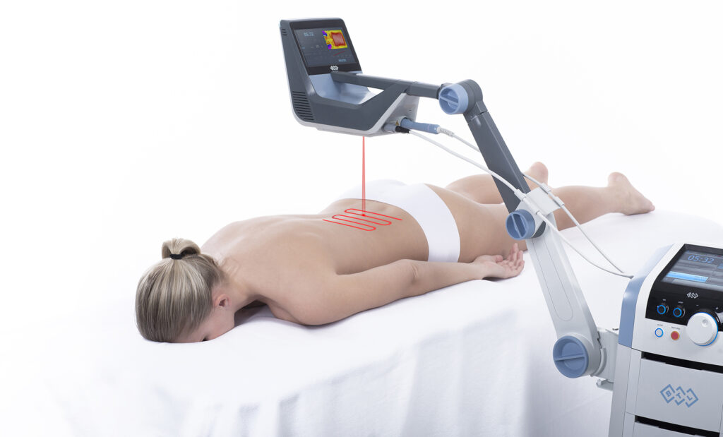Behandlung einer Patientin mit dem BTL-6000 Hochleistungslaser Robotic Scanning System von K2med