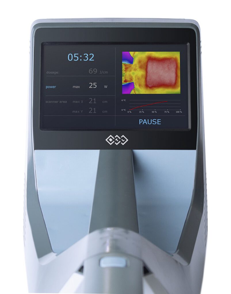 Behandlungsanzeige des BTL-6000 Hochleistungslaser Robotic Scanning System von K2med